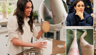 Meghan’s lawyer breaks silence after fan threatened £7m lawsuit because ‘bath salt recipe left catastrophic BURNS'