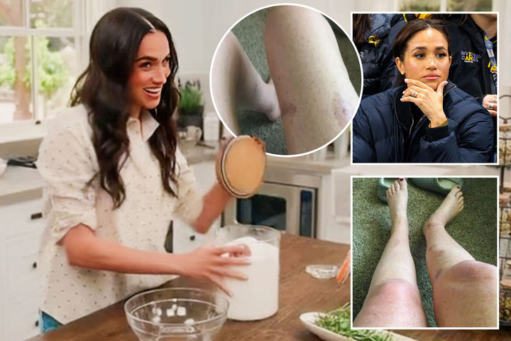 Meghan’s lawyer breaks silence after fan threatened £7m lawsuit because ‘bath salt recipe left catastrophic BURNS'