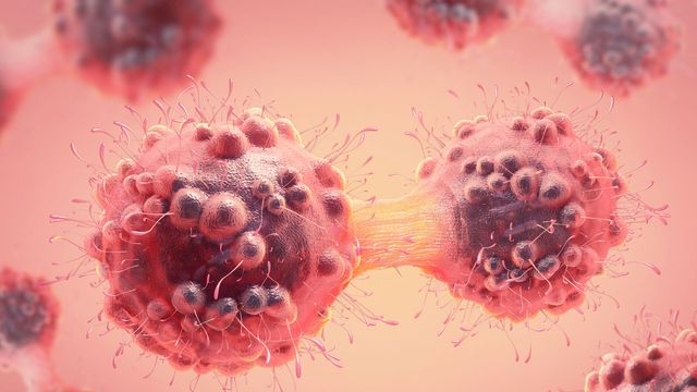 Wilms Tumors Study Uncovers Genetic Predisposition