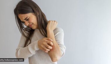 inflammation