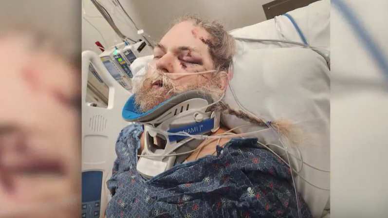Kentucky man left paralyzed after violent tornado ripped through London area