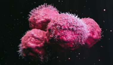 Genetic Changes in Wilms Tumour May Lead to Targeted Therapy