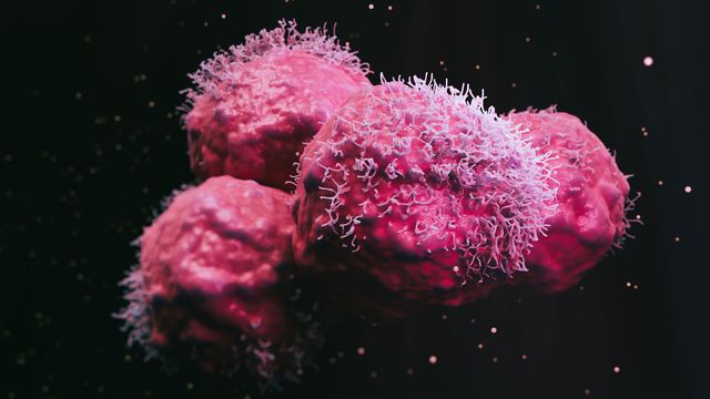 Genetic Changes in Wilms Tumour May Lead to Targeted Therapy