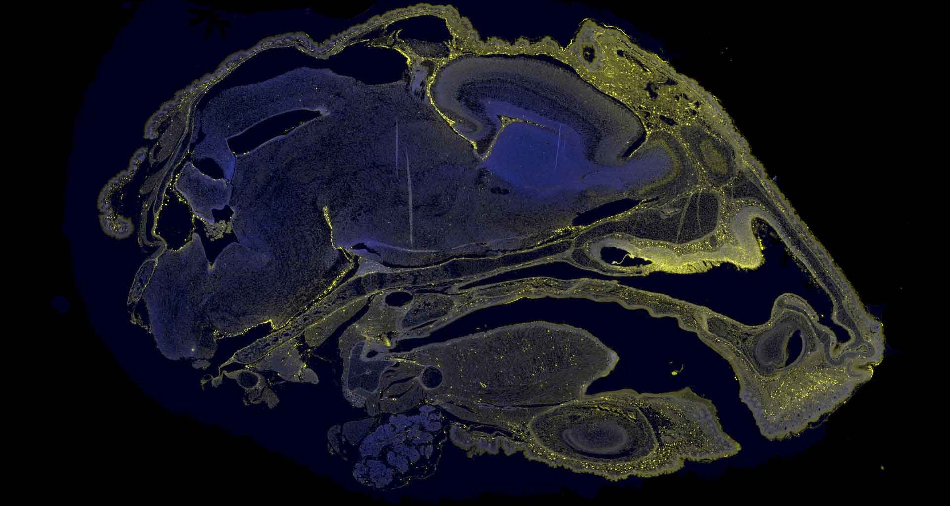 A microscopic image showing the biodistribution of therapeutic molecules in the brain of a fetal mouse, showing in yellow.