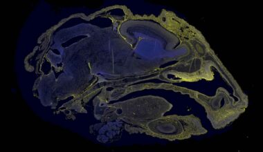 A microscopic image showing the biodistribution of therapeutic molecules in the brain of a fetal mouse, showing in yellow.