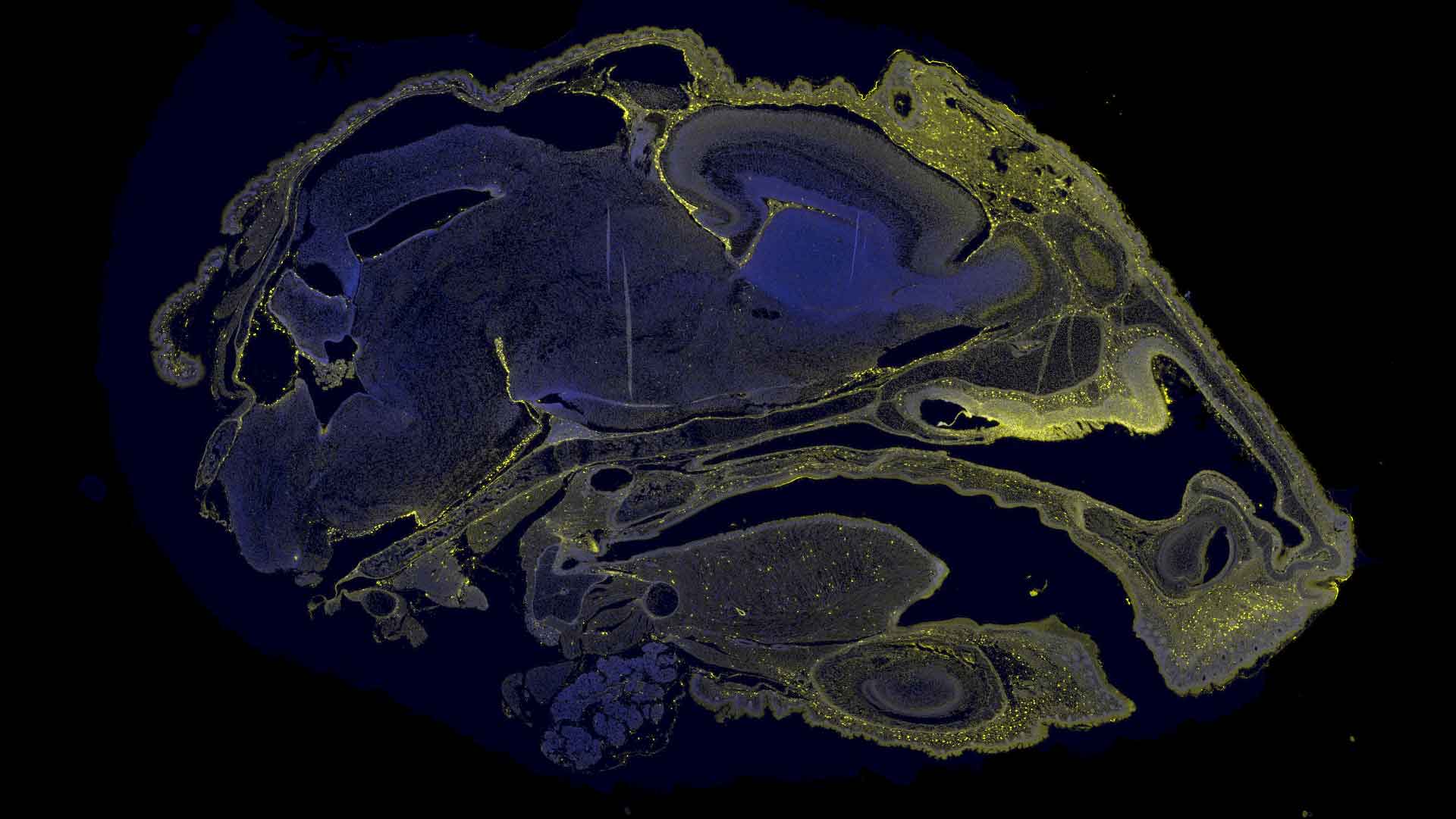 A microscopic image showing the biodistribution of therapeutic molecules in the brain of a fetal mouse, showing in yellow.