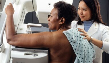 London breast screening improves yet women still miss checks