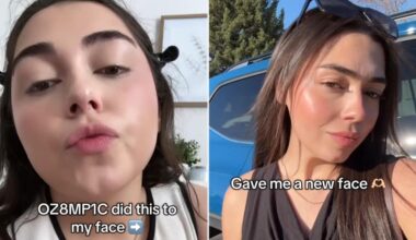 Woman loves how her 'Ozempic face' looks