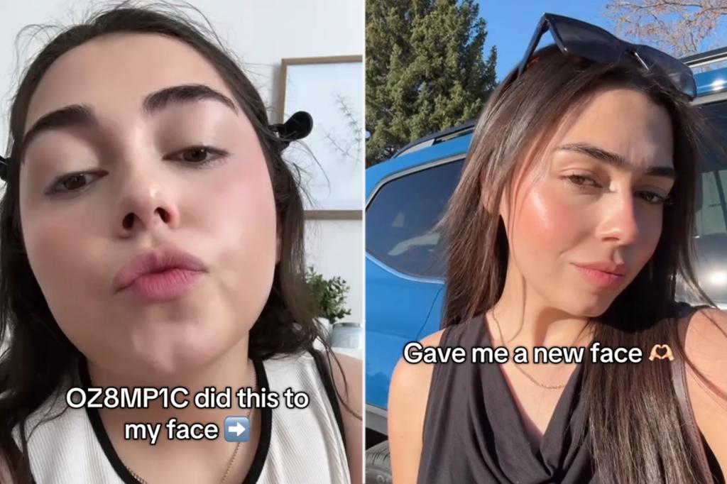 Woman loves how her 'Ozempic face' looks