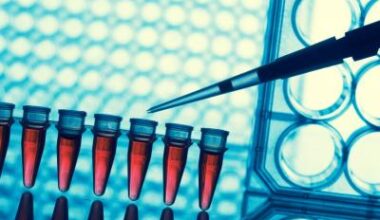 New blood test to enable rapid diagnosis of rare genetic diseases • healthcare-in-europe.com