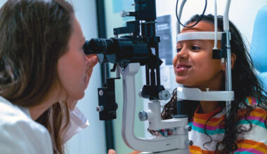 The coffee-coloured iris nodules that could indicate a rare genetic condition