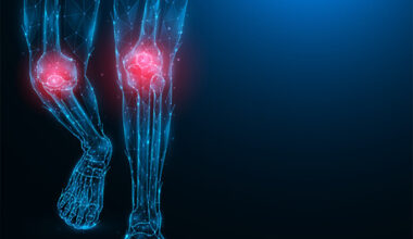 Osteoarthritis study uncovers new genetic links, drug targets