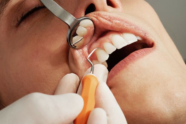 Dental treatment is not usually free