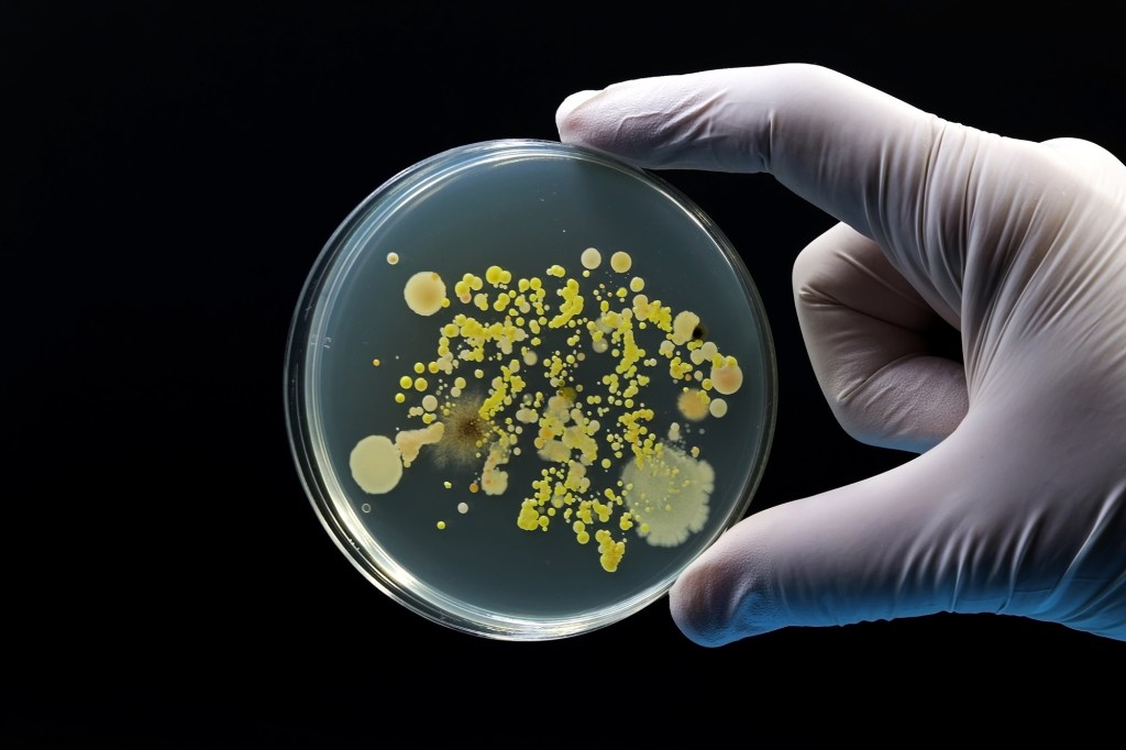Gloved hand holding a Petri dish with bacterial cultures.