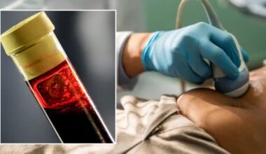 Supplement found to flush cancer-causing substance from body