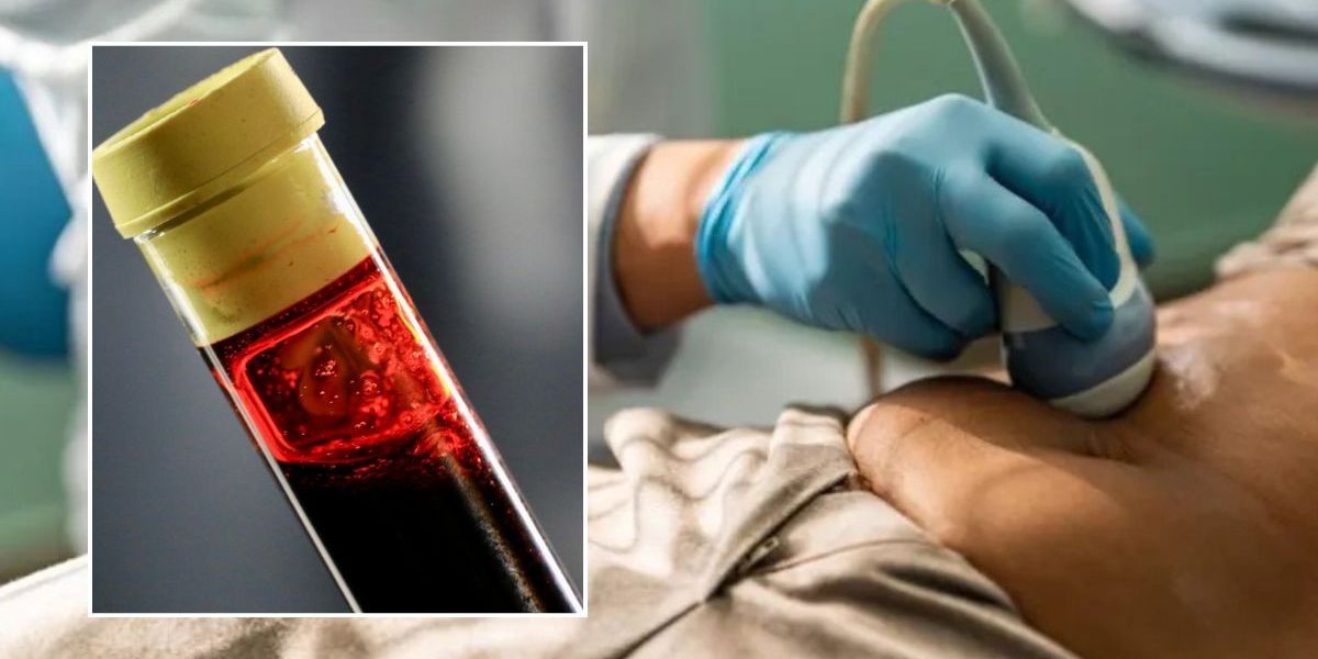 Supplement found to flush cancer-causing substance from body