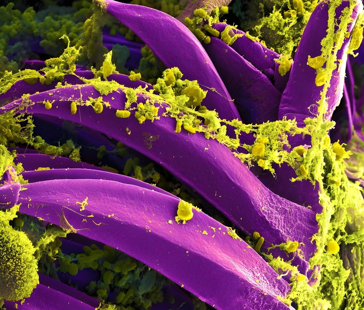 Black Death Plague Bacterium Became Less Fatal thanks to Just One Genetic Tweak