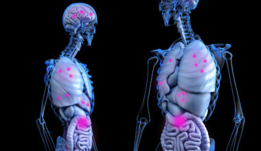 Genetic changes control metastasis formation in colorectal cancer