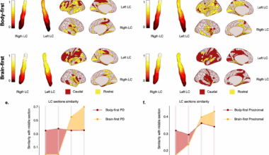 Clinical progression and genetic pathways in body-first and brain-first Parkinson’s disease | Molecular Neurodegeneration