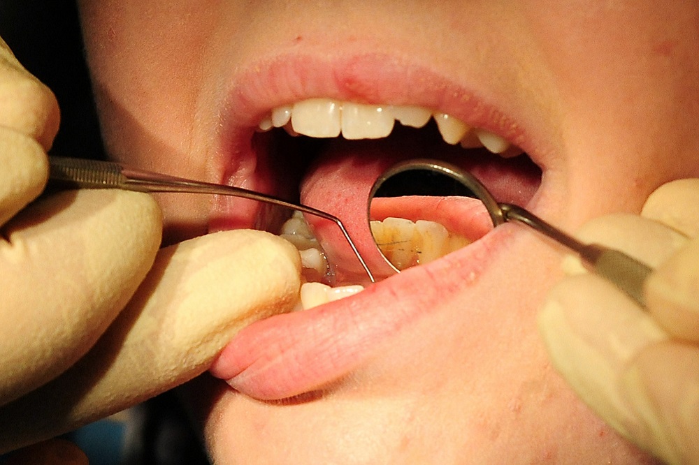 Crisis over north Wales dental care raised in Westminster
