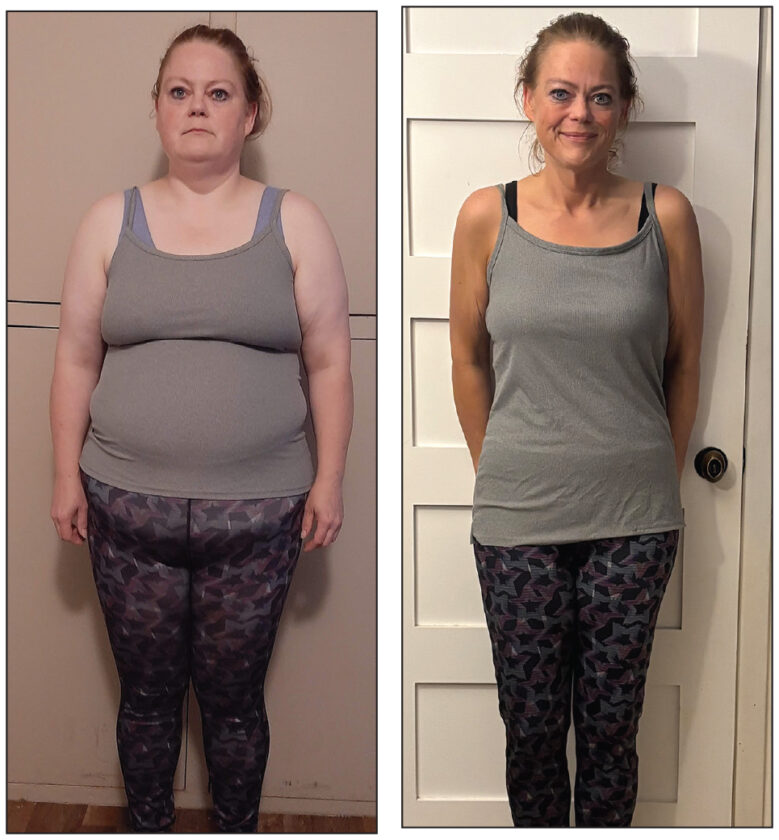 Local woman loses 110 pounds, shares diet and exercise tips | News, Sports, Jobs