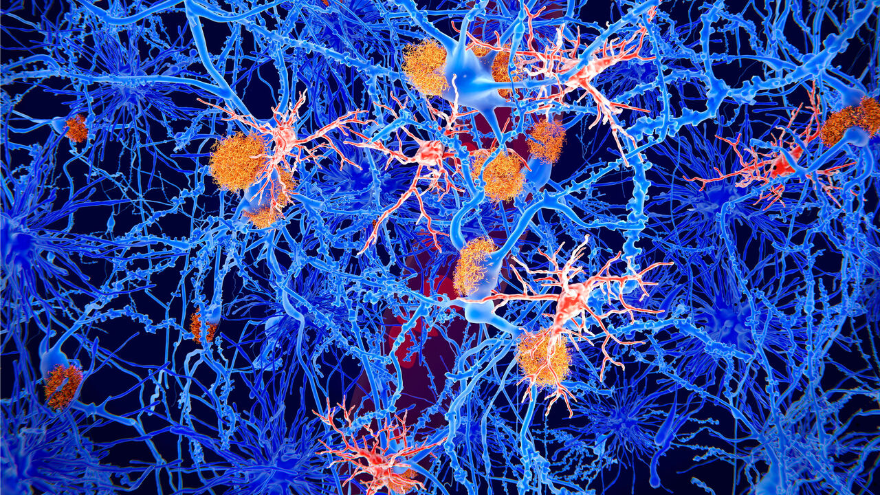 Amyloid and microglia cells in Alzheimer's disease.