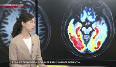 Late-life depression may be an early sign of dementia - nhk.or.jp