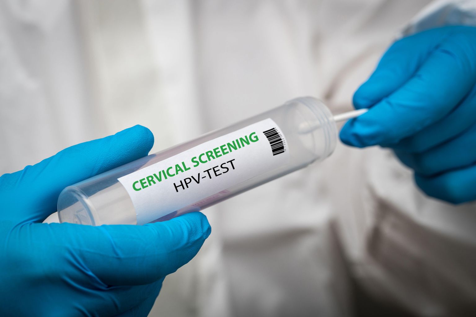 NI Screening body to consider recommendation that could allow for at-home smear tests in Northern Ireland