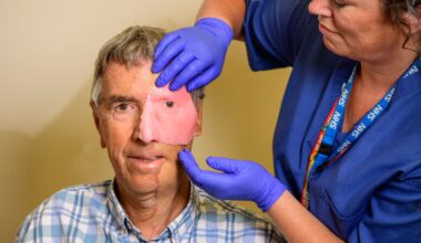 How an NHS team is changing lives — by 3D printing body parts