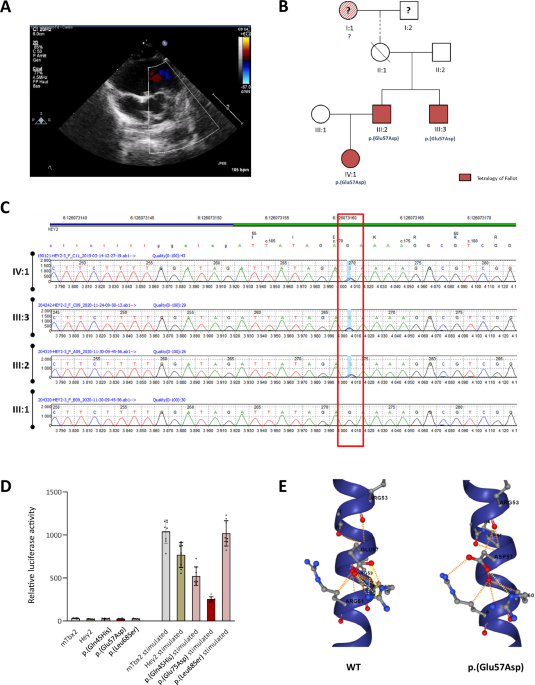 A novel heterozygous pathogenic variant in HEY2 led to a familial form of non-syndromic Tetralogy of Fallot