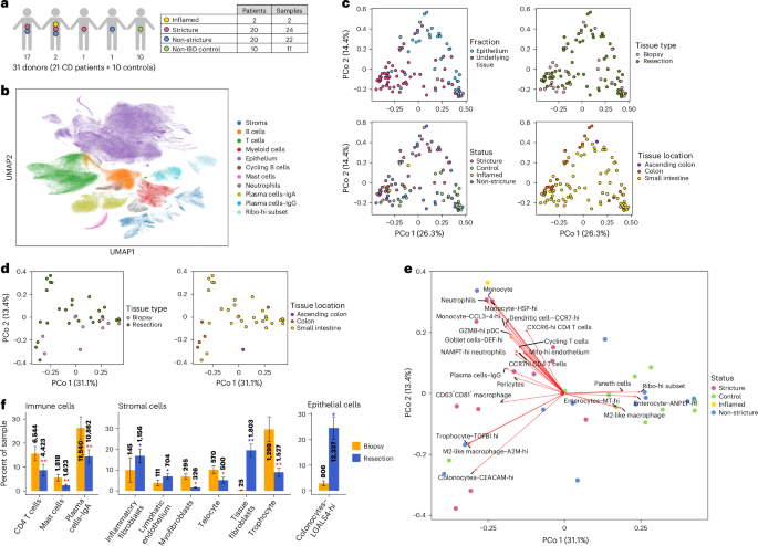 Single-cell and spatial transcriptomics of stricturing Crohn’s disease highlights a fibrosis-associated network