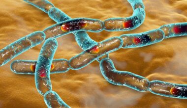 Anthrax outbreak alert after one killed and three taken to hospital