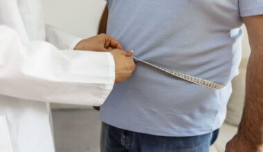 NHS confirms access criteria for GP-prescribed Mounjaro