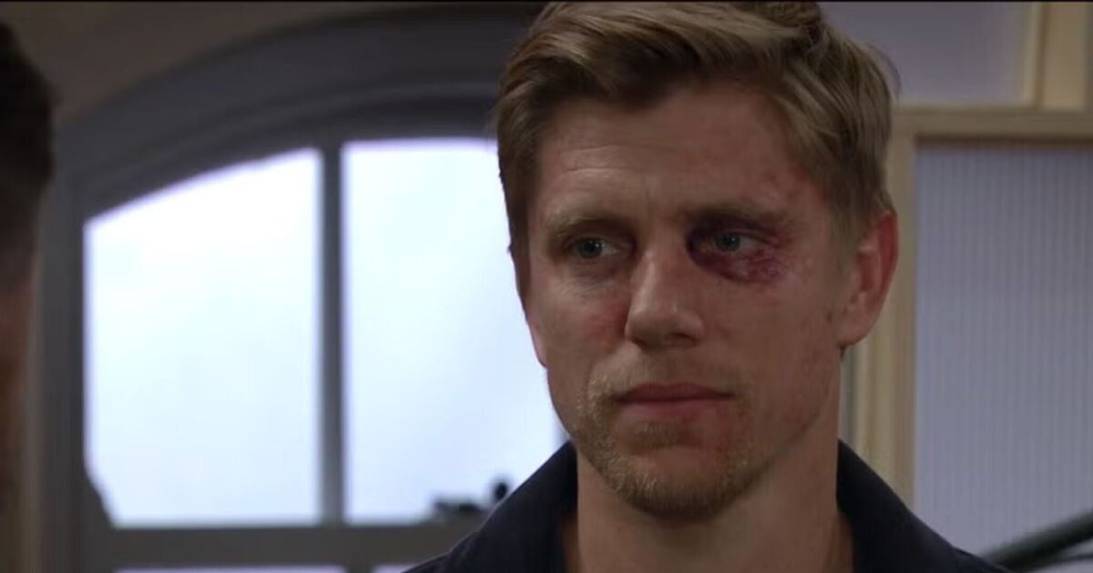 Emmerdale fans sob as Robert Sugden suffers major setback after prison release | TV & Radio | Showbiz & TV