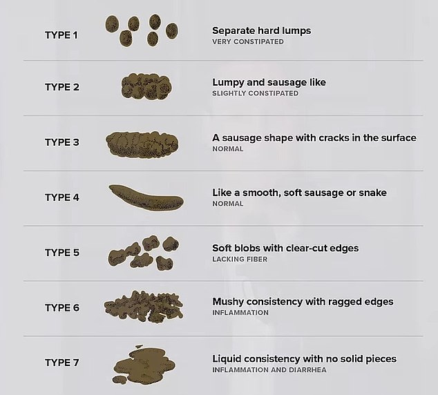 Doctors often refer to the Bristol Stool Chart in clinical practice to assess the health of a person's bowel movements
