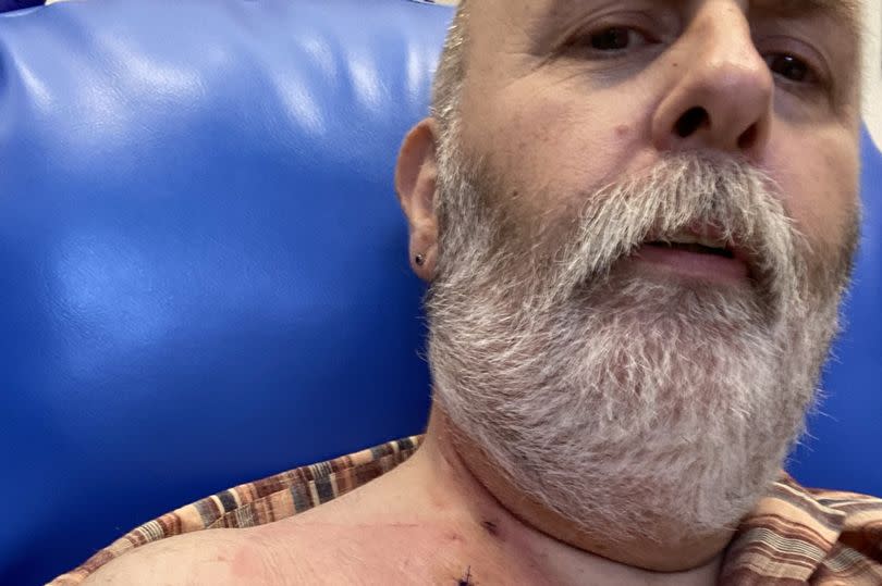 Brendan during his treatment