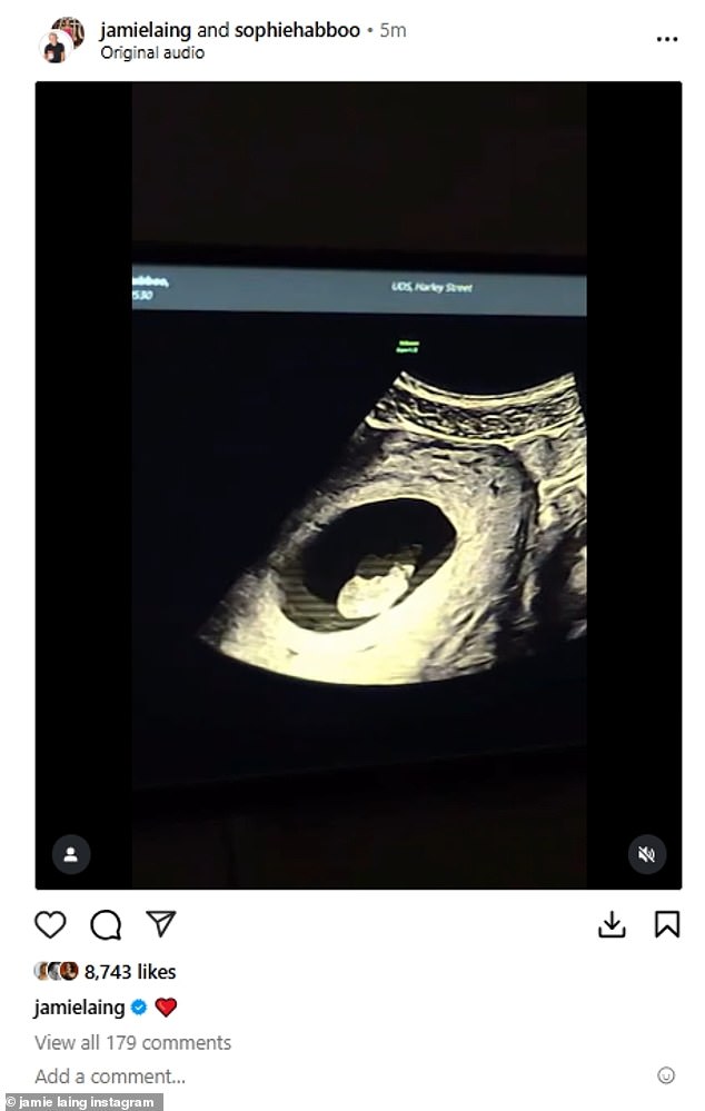 The sweet clip showed them having an ultrasound as Sophie looked delighted starring at the screen