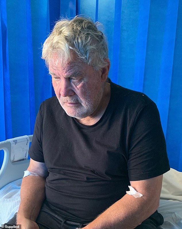 A recent photo of Eadie dramatically demonstrates the toll his battle with the deadly brain condition CTE has taken on him