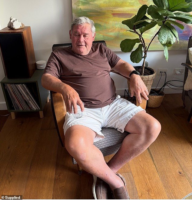 The former fullback has gone from being rated one of the best footy players Australia has ever produced to suffering from seizures and delirium