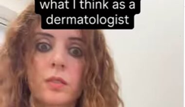Dr Fatima Awdeh has shared some commonly overlooked symptoms of skin cancer