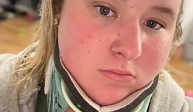 Maisie Moore, 25 (pictured) from south West London, spends every day sequestered to her bed in a brace given her severe neck pain, alongside other symptoms that include high blood pressure, a racing heart and intense feelings of nausea