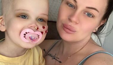 Carlyn Dooley (right), from Corby, rushed her daughter, Paisley (left), to hospital on April 2 after she woke up with black rings around her eyes