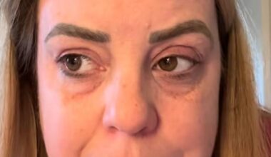 Jane Roberts, 46, began experiencing confusion and forgetfulness earlier this year, but assumed it was a harmless symptom of perimenopause.