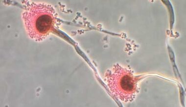 Aspergillus fungus is a toxic fungus that kills up to 50 percent of patients. But researchers have found some forms of it may help treat leukemia