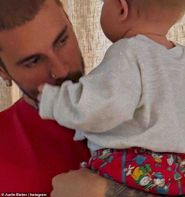 While Justin, 31, and the Rhode founder haven't yet revealed their nearly one-year-old child's face, pictures featuring his tiny wrist show that Jack is already reaping the benefits of his parents' nine-figure fortune