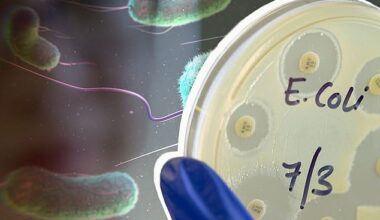 The UK Health Security Agency says there were 2,063 confirmed cases of Shiga-related E. coli infections in England in 2022