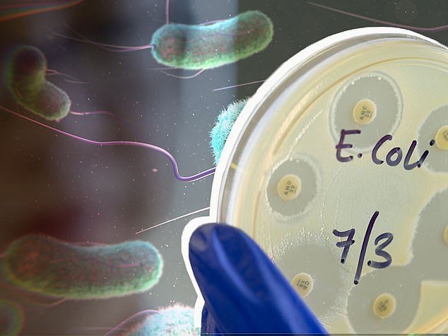 The UK Health Security Agency says there were 2,063 confirmed cases of Shiga-related E. coli infections in England in 2022