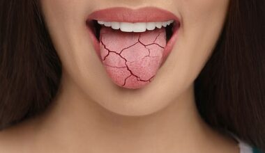 It’s hoped the breakthrough will lead to a new treatment of lab-grown cells that can be transplanted into the mouths of patients suffering persistent dry mouth