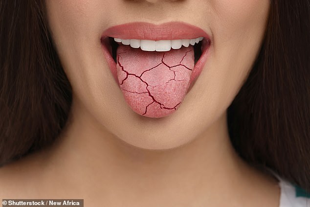 It’s hoped the breakthrough will lead to a new treatment of lab-grown cells that can be transplanted into the mouths of patients suffering persistent dry mouth