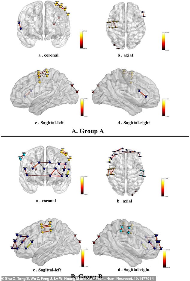 Low-frequency users demonstrated stronger connectivity in brain regions involved in language processing, movement coordination and sensory input. While the high-frequency users showed increased connectivity in areas associated with executive functions